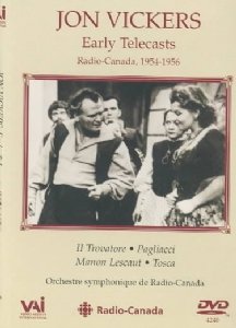 【中古】His Early Television Performances [DVD]