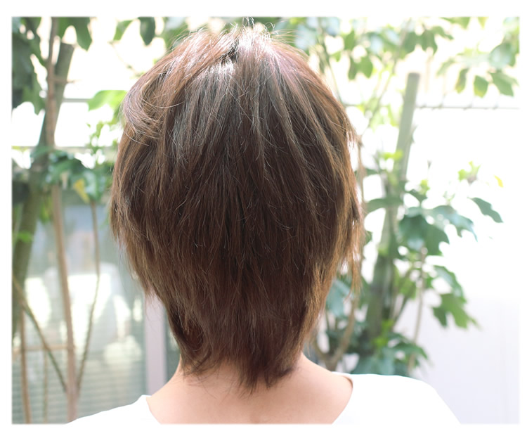 熱い夏を好いたらしいに！涼しさを重視した診療用ウィッグ