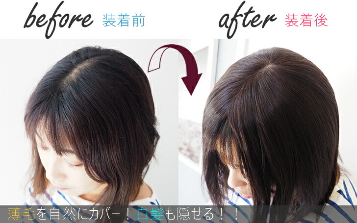 人毛100 部分ウィッグ ヘアピース シルク幅広皮膚ヘアピース3l つむじ ロング 部分かつら 医療用ウィッグ 部分 抗がん剤 セミロング ミディアム 人毛ウィッグ 総手植え 人工皮膚 レディース 夏用 薄毛 あっちパパ 円形脱毛症 ポイントウィッグ カバーピース 送料無料