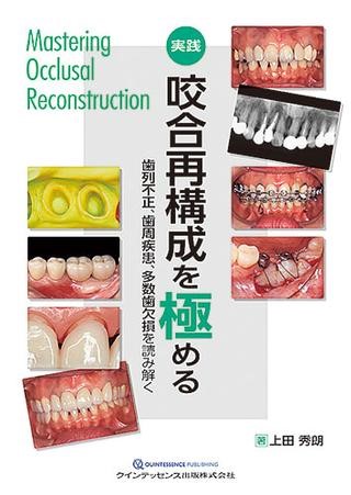ハンディ咬合器 楽天市場】咬合器（デンタルケア｜ダイエット・健康）の通販