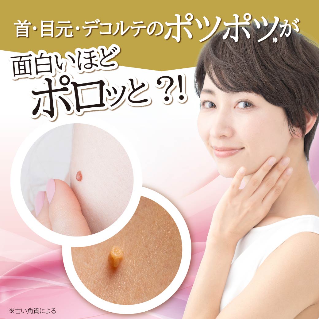 楽天市場 イボ イボ取り 首 ポツポツ アイポロン アエナ楽天市場店