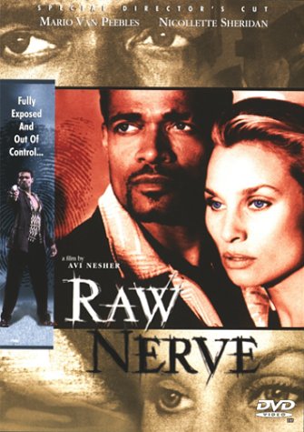 【中古】【未使用・未開封品】Raw Nerve
