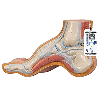 【中古】【未使用・未開封品】3B Scientific M32 Hollow Foot (Pes Cavus) Joint Model, 13cm x 23cm x 9.9cm