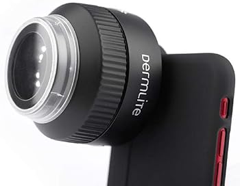 【中古】3Gen DermLite FOTO デジタル脱毛マイクロスコープ取り合わせ