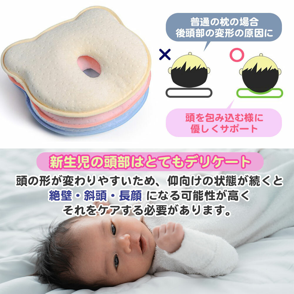 赤ちゃん 枕 矯正 頭の形 絶壁 向き癖 ドーナツ枕 傾斜 ベビー枕