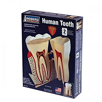 【中古】【輸入品・未使用】リンドバーグ 8/1 人体模型パーツ歯