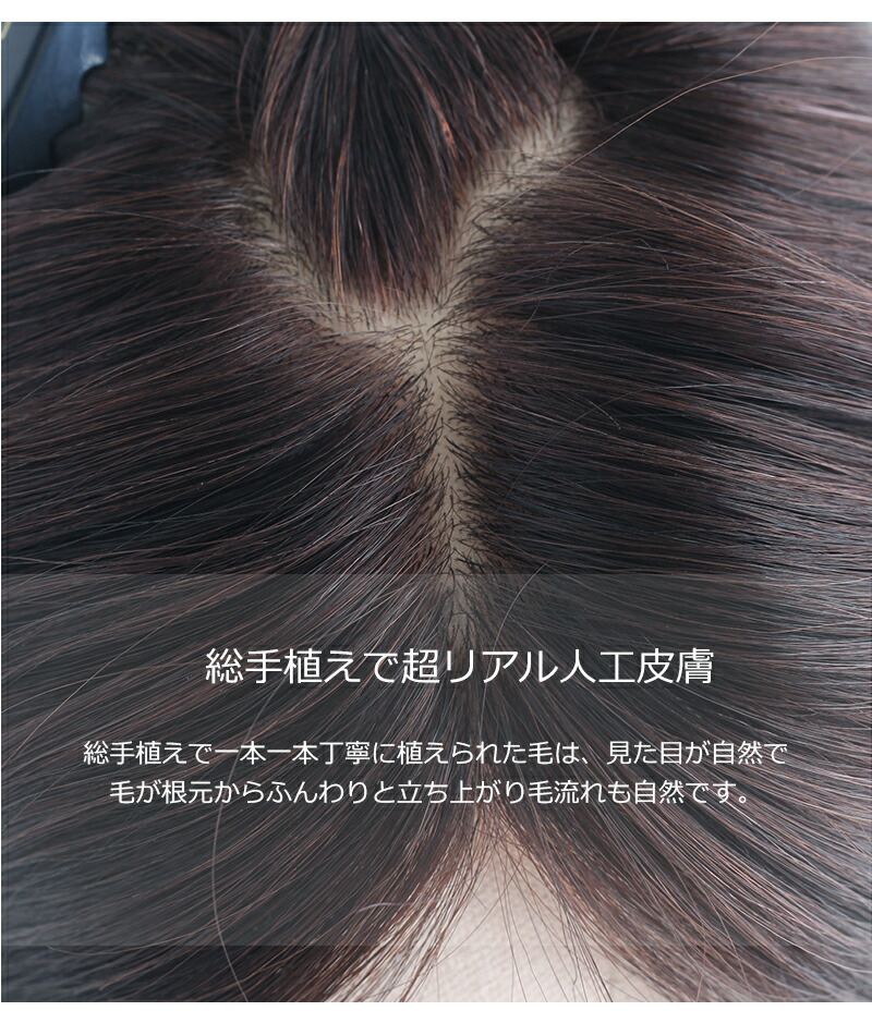 増毛かつらの頭頂部画像_BHAD710