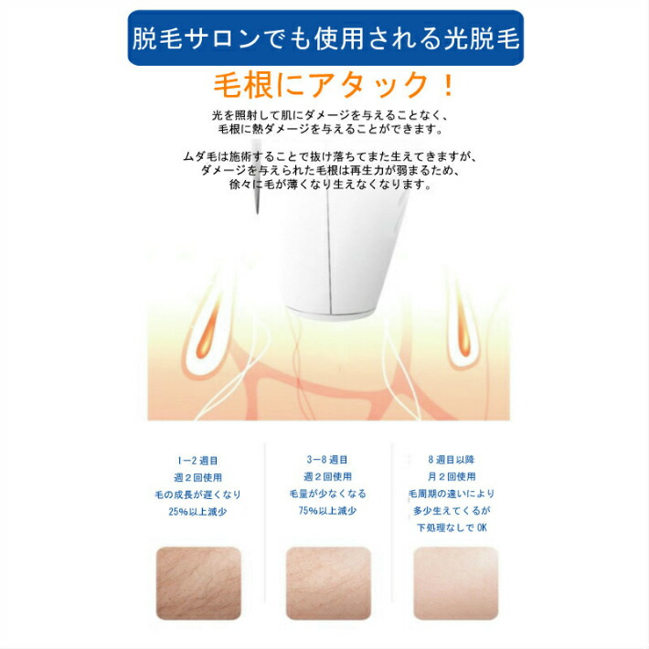 年のクリスマス Ipl 光 脱毛器 90万回 フラッシュ ライト交換不要 家庭用 脱毛機 美顔器 ヒゲ脱毛 レーザー 全身 脱毛 メンズ レディース ムダ毛 処理 デリケートゾーン アンダーヘア Vioライン 顔 背中 ボディ フェイス ヒゲ ひげ 髭 脇 腕 指 ワキ