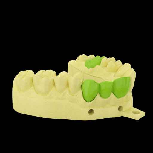 楽天市場 Resinworks3d 歯科用モデルhdレジン アイボリー500g Lcd光造形 3dプリンター用 Anycubic Photon Bean Flashforge Phrozen 3dプリンター Wanhao およびその他のlcdベースのプリンター Dental Model White Ayard