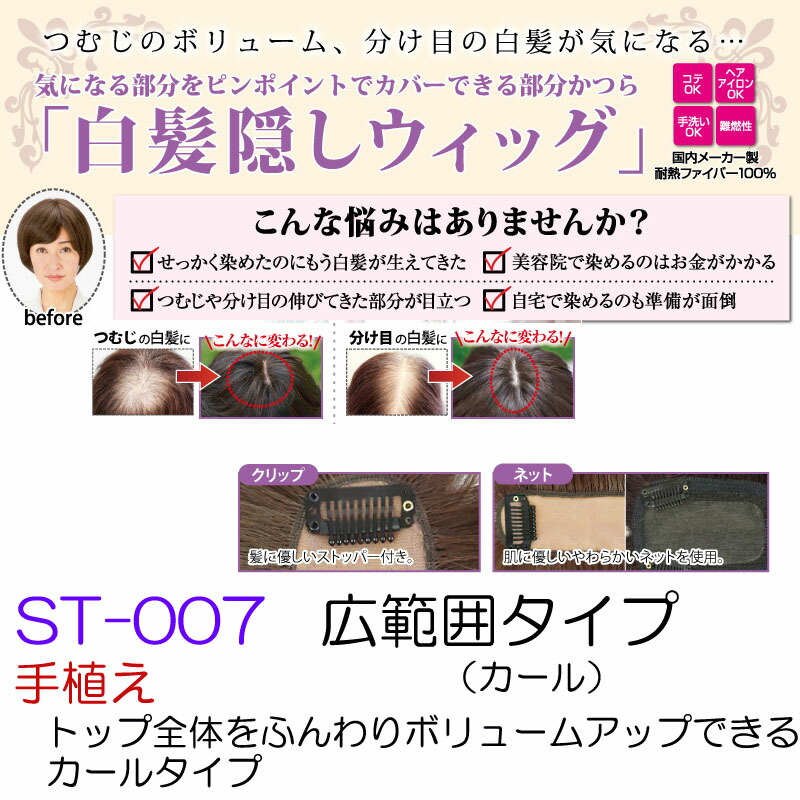白髪掩蔽ウィッグ 広限りジャンル 縮らす St 007 部局分品ウィッグ 頭頂部 本延び 部分髪の毛 嚊 ウィッグ 被せる平和 増毛かつら 部分かつら 部分用法 ウイッグ ヘアピース 独りでに 部分つけ毛 つむじ隠し 白髪かくし 女子 50価 60代 Cannes Encheres Com