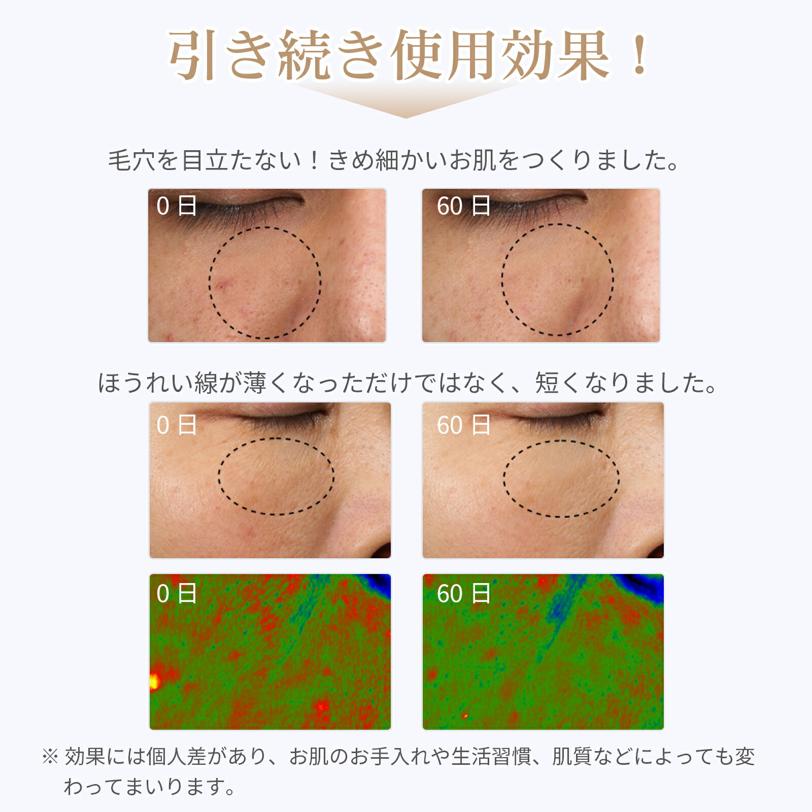 LED光エステ美顔マスク5色IPX7防水95g軽量3段階温熱モードPU材質LEDライト59球5色光モード光エステマスク型遮光アイマスク付き家庭用マスク型美顔器美容美顔器光美容器LED美容器LED美顔マスクLED美容マスク5色美顔マスクANLAN