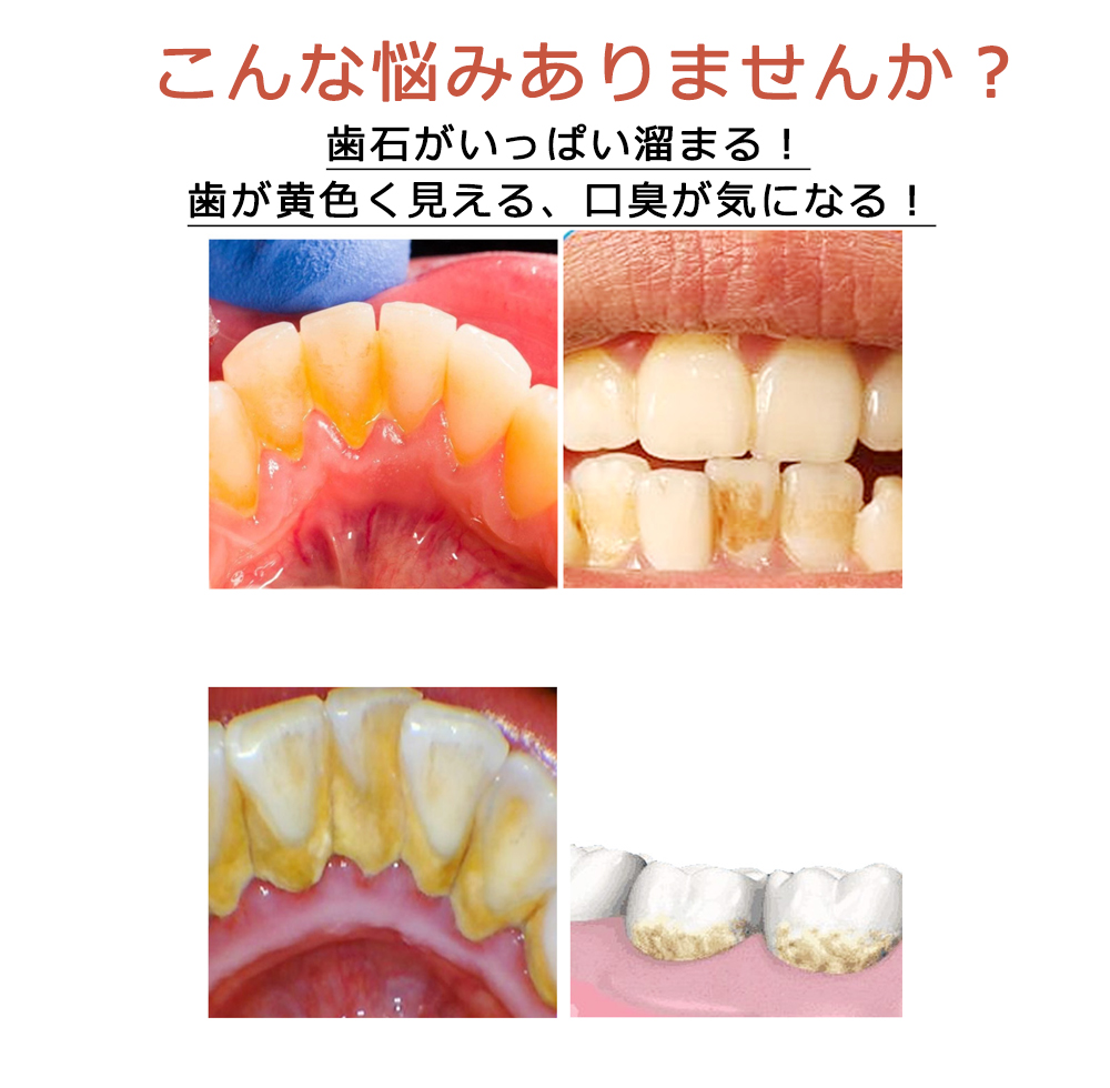 受賞店舗】 ランキング１位 電動歯ブラシ 口腔洗浄器 歯石取り スケーラー 超音波 電気歯クリーナー 歯用ツール 高周波振動 電気歯洗浄機 歯茎 歯垢  電動ブラシ 防水 LED 歯石除去 口腔ケア 口臭防止 歯周病予防 qdtek.vn