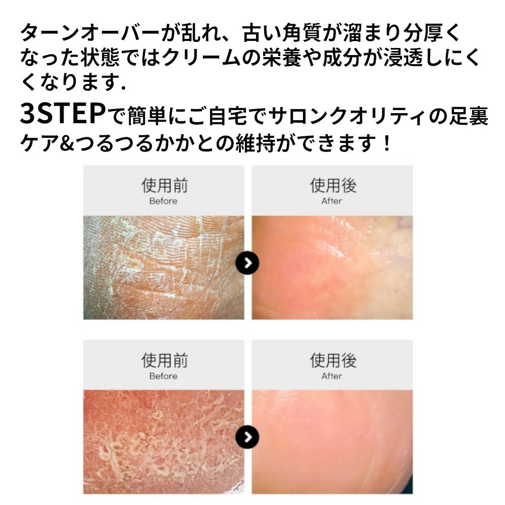 市場 コウンバル コウンバルクリーム シャイニーフット 赤 エミューオイル配合 フットファイル かかと角質ケア3点セット