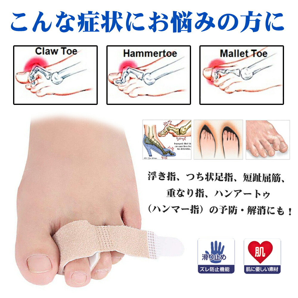 楽天市場 足指矯正パッド 4枚入 指間保護 足指サポーター 衝撃吸収 痛み軽減 指間矯正 手指 足指固定サポーター つま先 足指パッド 浮指 つち状 足指 ハンマートゥ 指間広げる Bhcanae楽天市場店 楽天市場 足指矯正パッド 4枚入 指間保護 足指サポーター 衝撃吸収 痛み軽減 指間矯正 手指 足指固定サポーター つま先 足指パッド 浮指 つち状 足指 ハンマートゥ 指間広げる Bhcanae楽天市場店
