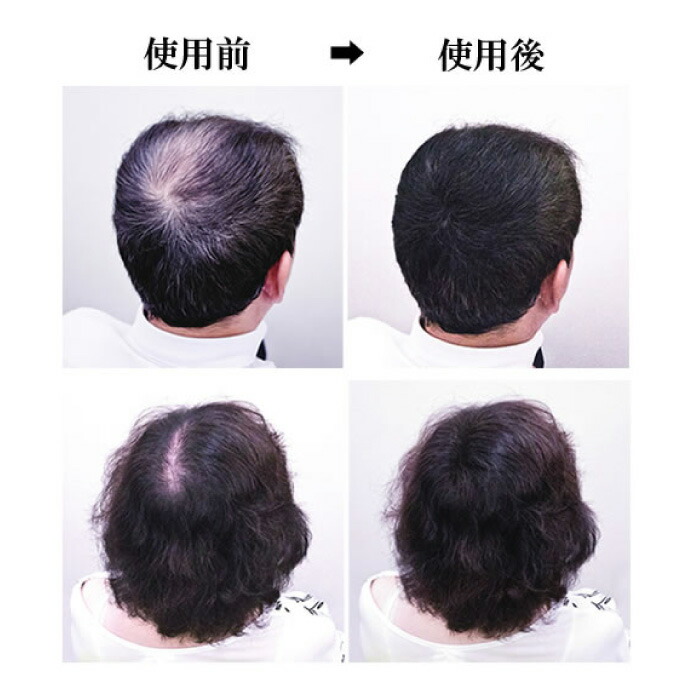 送料無料 ３本セット シークレットプラス ダークブラウン 50g マジックパウダーなどの薄毛隠しをお使いの方におすすめ！ ウィッグ・つけ毛 