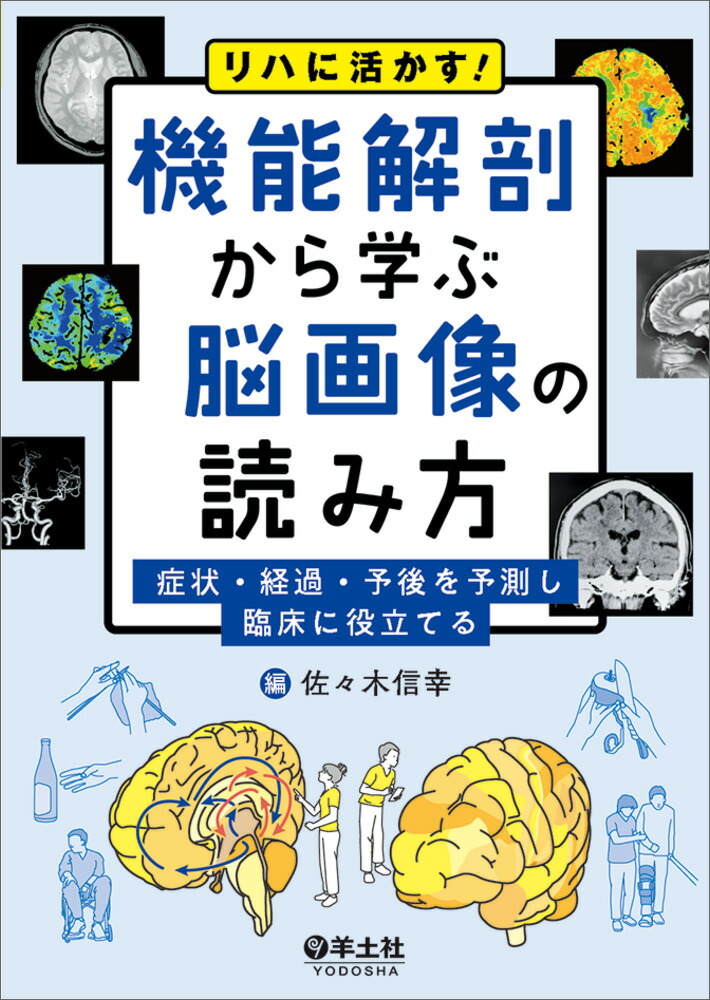 リハに活かす！機能解剖から学ぶ脳画像の読み方[佐々木信幸]