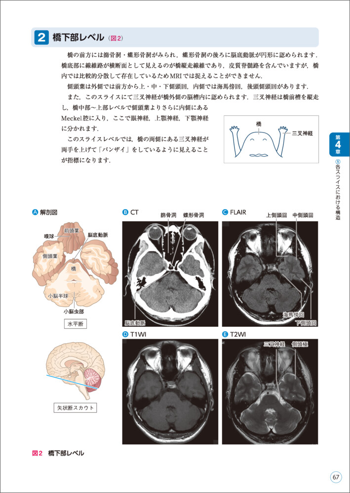 リハに活かす！機能解剖から学ぶ脳画像の読み方[佐々木信幸]