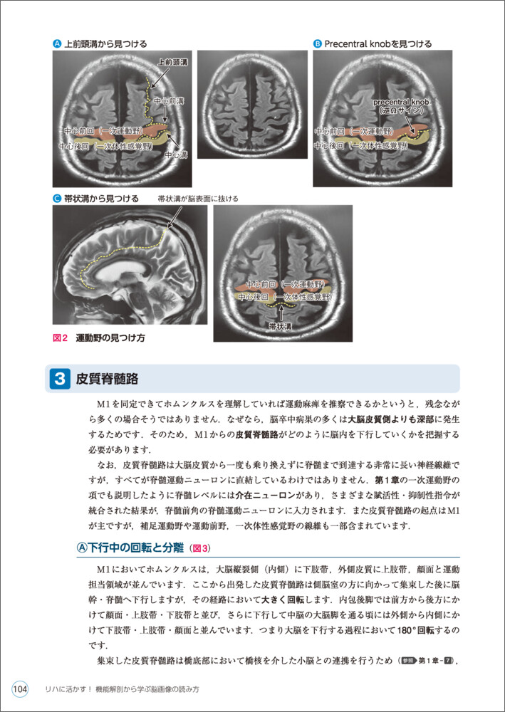 リハに活かす！機能解剖から学ぶ脳画像の読み方[佐々木信幸]