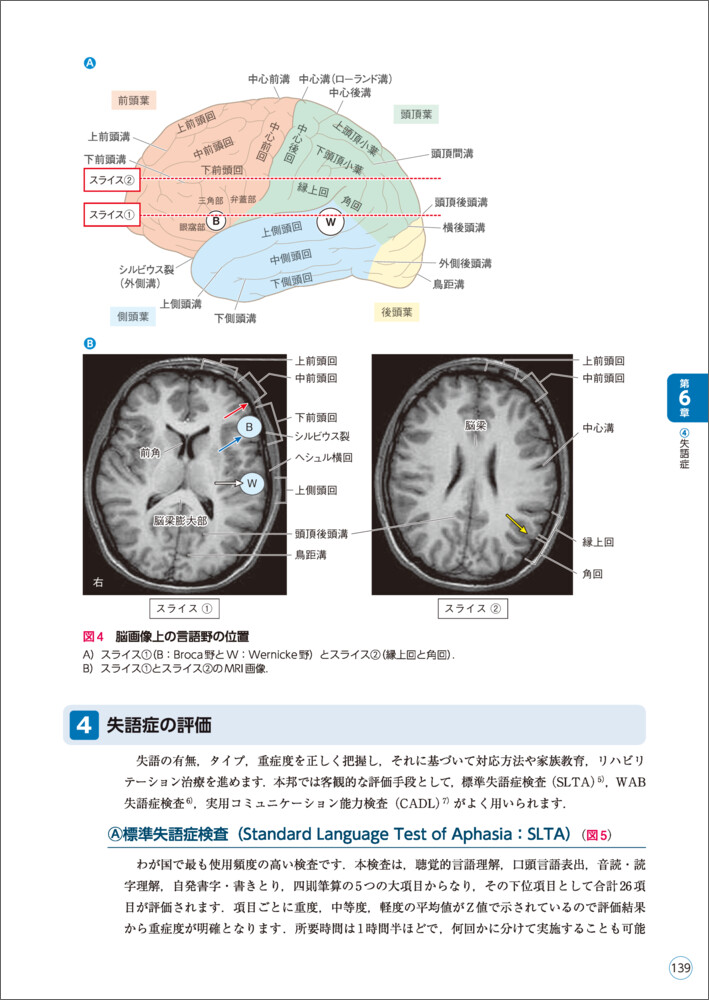 リハに活かす！機能解剖から学ぶ脳画像の読み方[佐々木信幸]