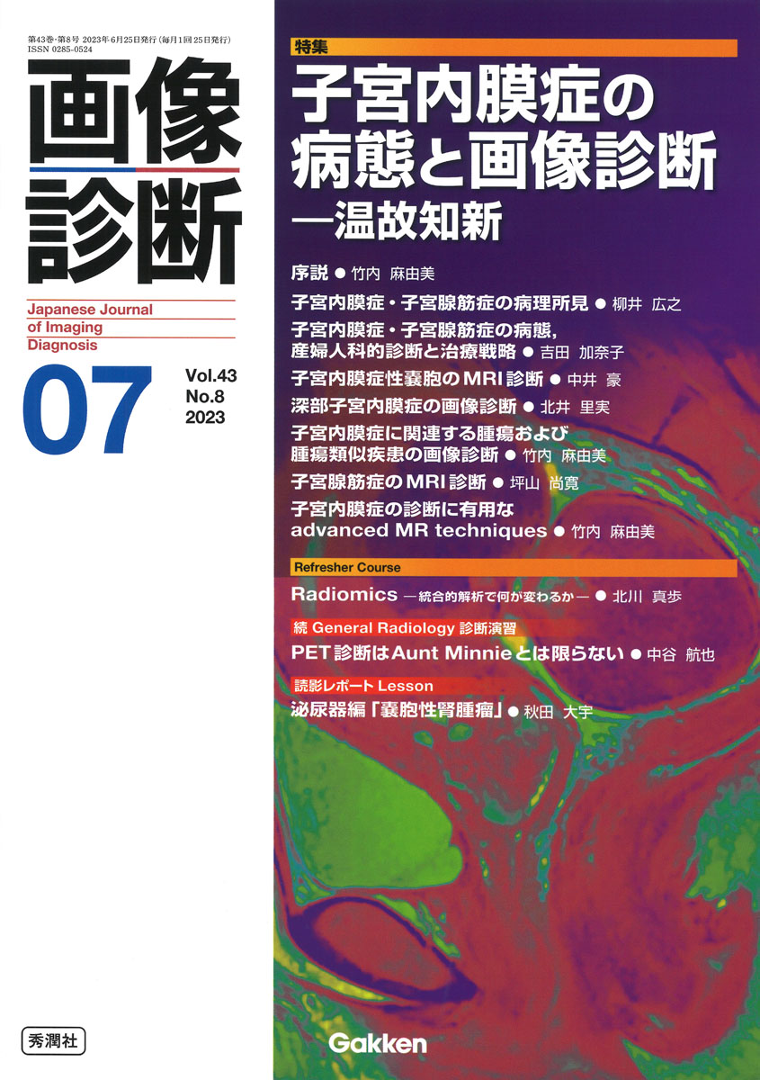 画像診断2023年7月号　Vol．43　No．8 子宮内膜症の病態と画像診断　-温故知新