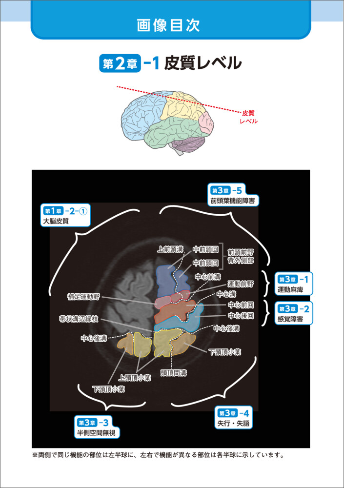Ǿ�����˽񤭹��ߤʤ���ȤˤĤ��롪�ɤ����ȥ�ϤǤγ褫����[���ͽ��]