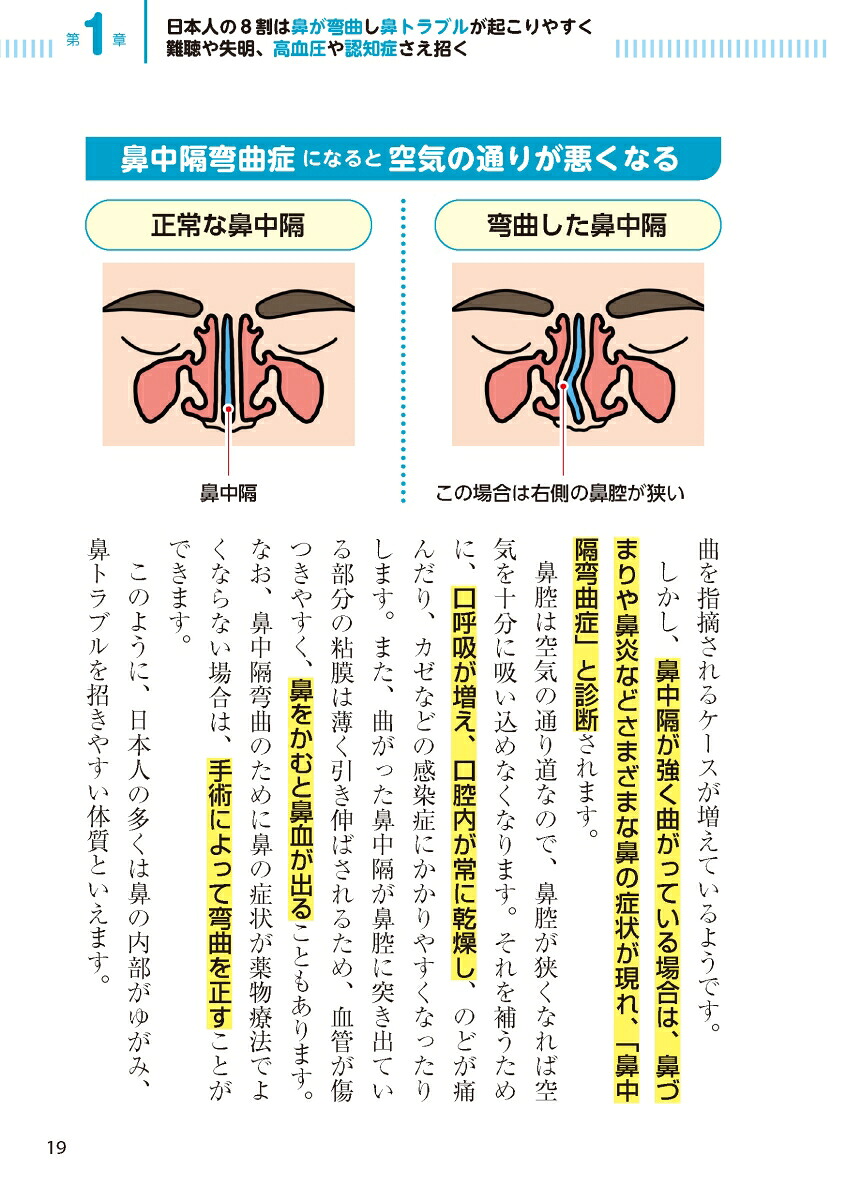 副鼻腔炎ちくのう花粉症・アレルギー性鼻炎・後鼻漏鼻づまり・鼻水スッキリ！鼻の名医陣が教える最新1分体操大全[大久保公裕]