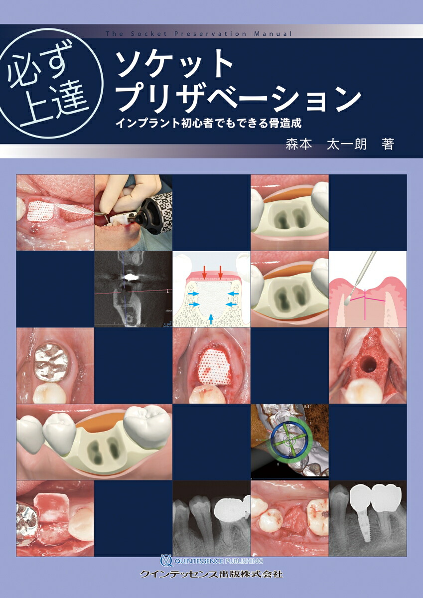 楽天ブックス: 必ず上達 ソケットプリザベーション