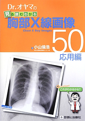 楽天ブックス: Dr．オヤマの見る読むわかる胸部X線画像50（応用編