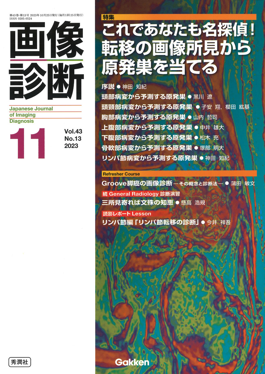 IVRのすべて 放射線・画像診断