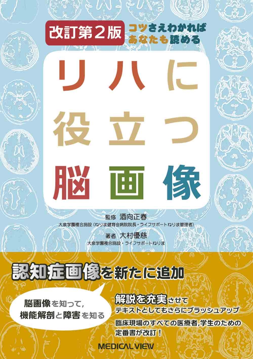 楽天市場 新品 リハに役立つ脳画像 コツさえわかればあなたも読める 大村優慈 著 酒向正春 監修 ドラマ 本と中古ゲームの販売買取