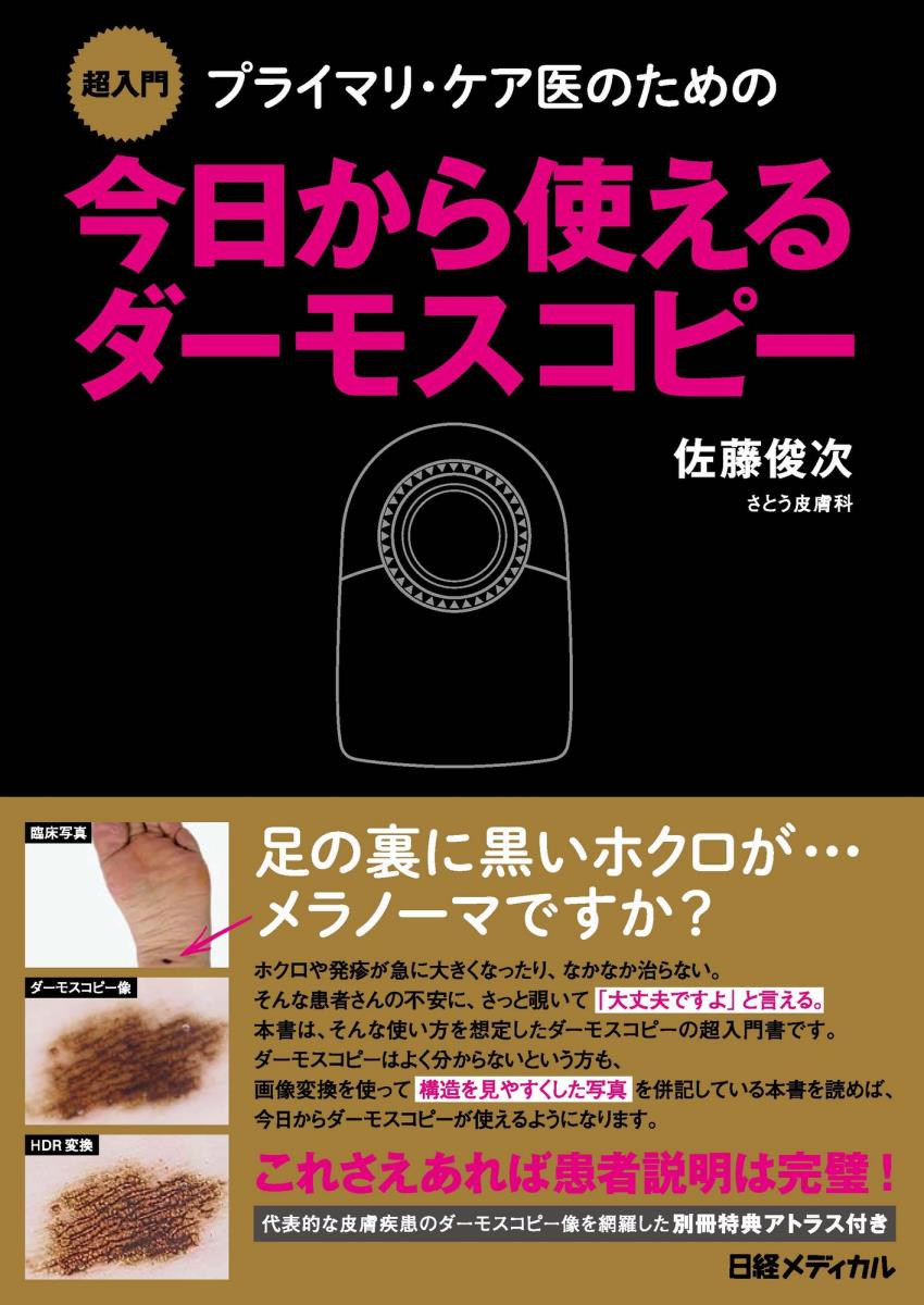 楽天ブックス 超入門 プライマリ ケア医のための今日から使えるダーモスコピー 佐藤 俊次 本