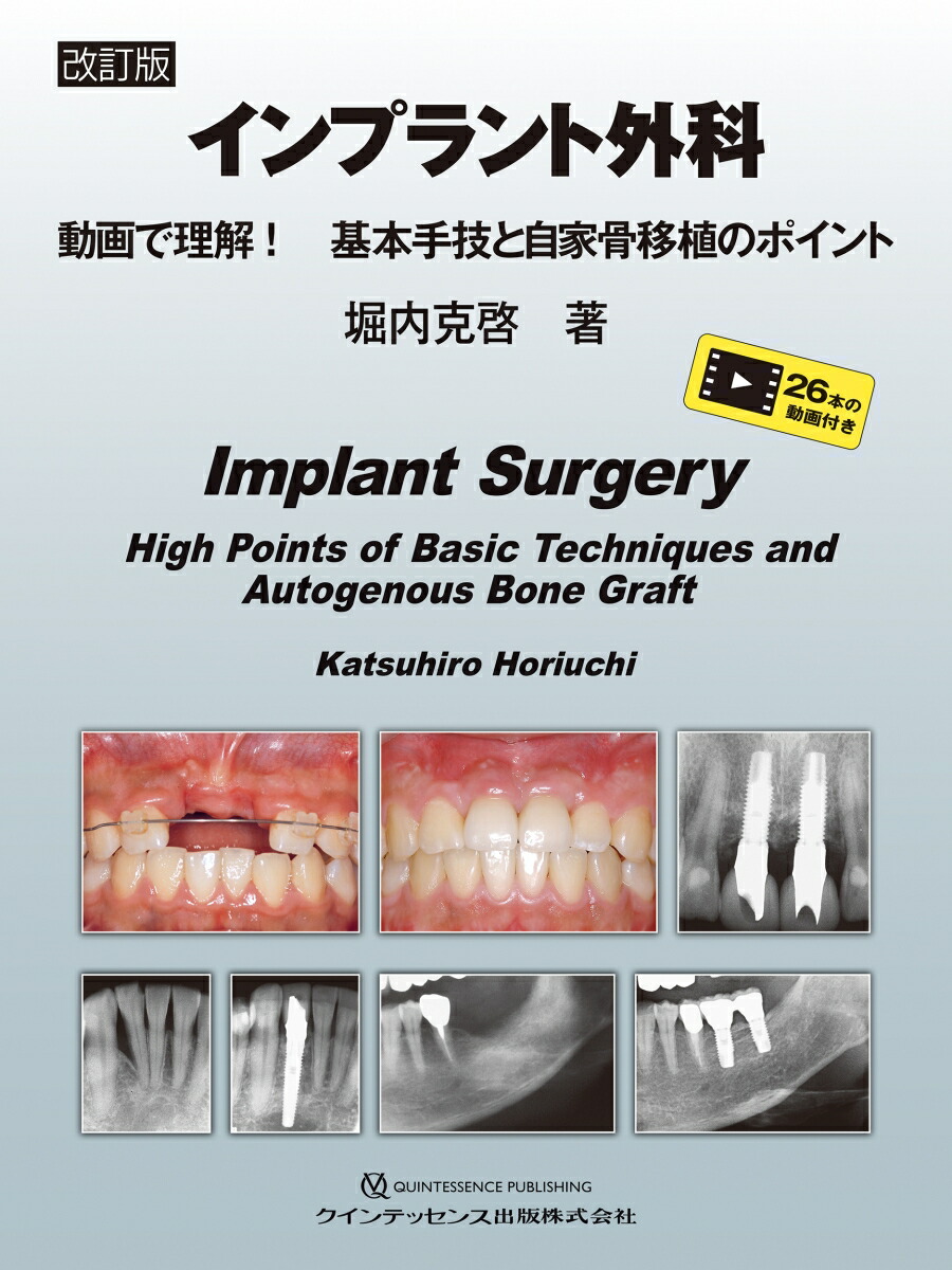 楽天市場】[書籍] イラストでみる口腔外科手術 第4巻【送料無料