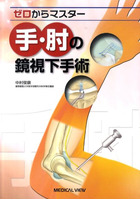 メジカルビュー社｜整形外科｜ゼロからマスター 肩の鏡視下手術