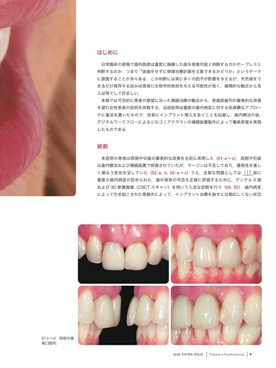 「補綴臨床digitalandinternational」増刊号第59巻2号デジタル審美修復の世界標準審美補綴・インプラント・クリニカルスタディ[雑誌]