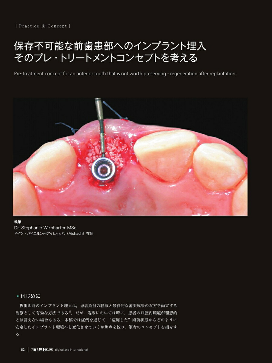 「補綴臨床digitalandinternational」増刊号第59巻2号デジタル審美修復の世界標準審美補綴・インプラント・クリニカルスタディ[雑誌]