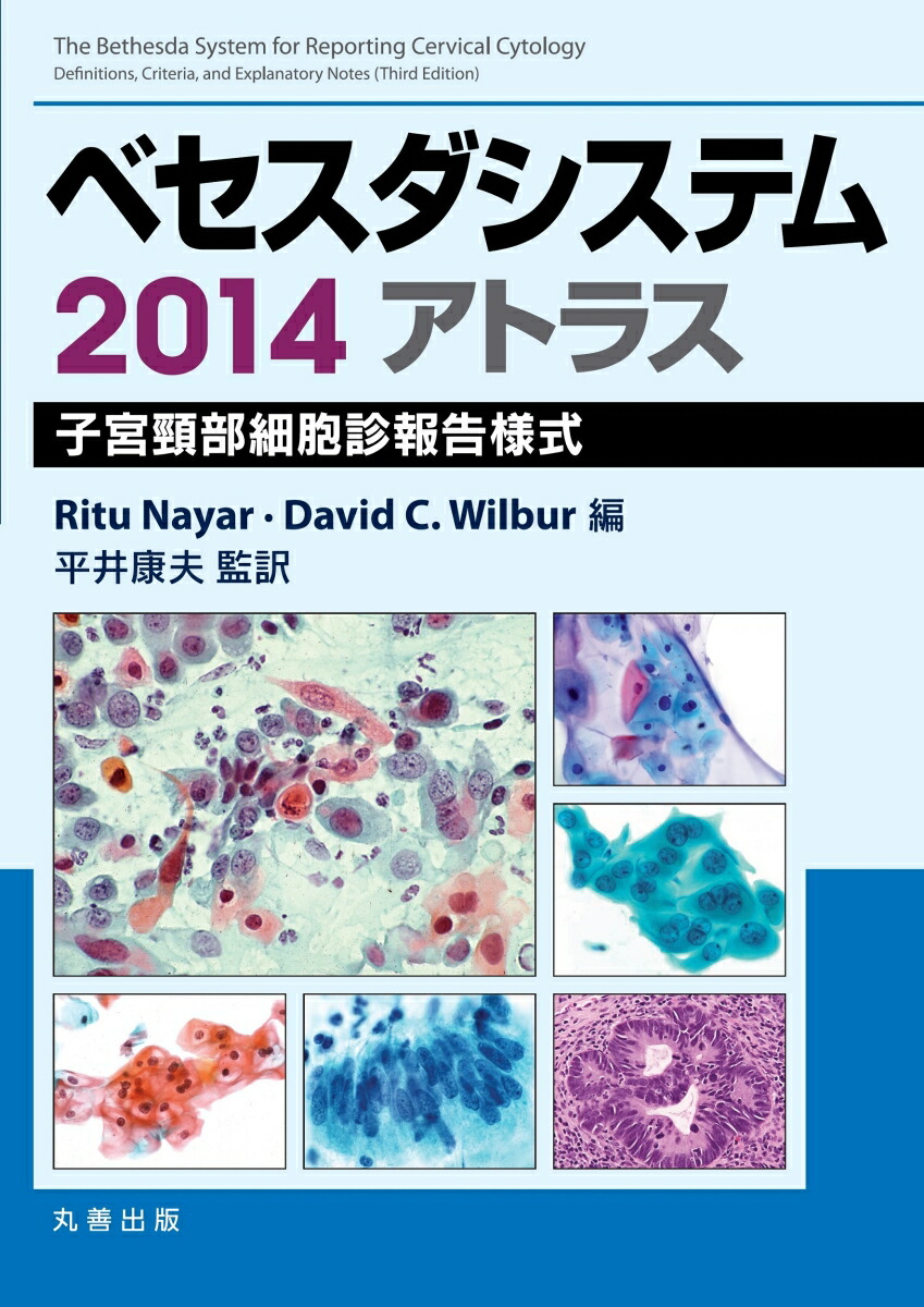 楽天ブックス: ベセスダシステム2014アトラス〈原書3版〉 子宮頸 楽天ブックス: ベセスダシステム2014アトラス〈原書3版〉 子宮頸