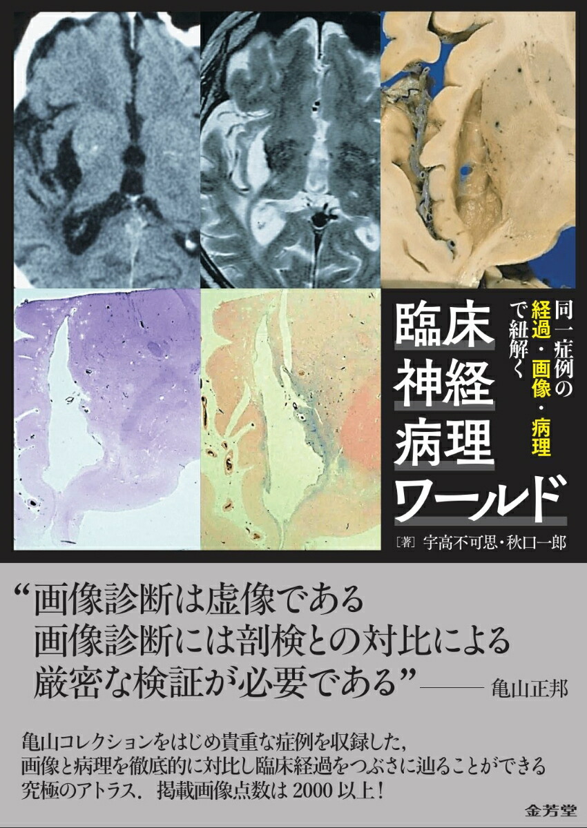 臨床神経病理ワールド 楽天ブックス: 同一症例の経過・画像・病理で紐解く 臨床神経病理