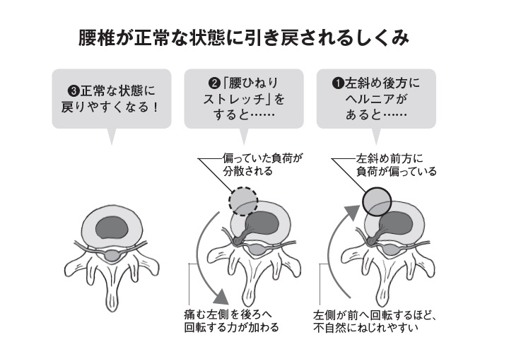 楽天ブックス 坐骨神経痛は自分で治せる 椎間板ヘルニア 脊柱管狭窄症のかたにも 酒井慎太郎 本