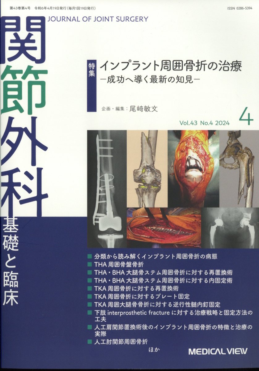 関節外科 基礎と臨床 2024年 4月号 [雑誌]