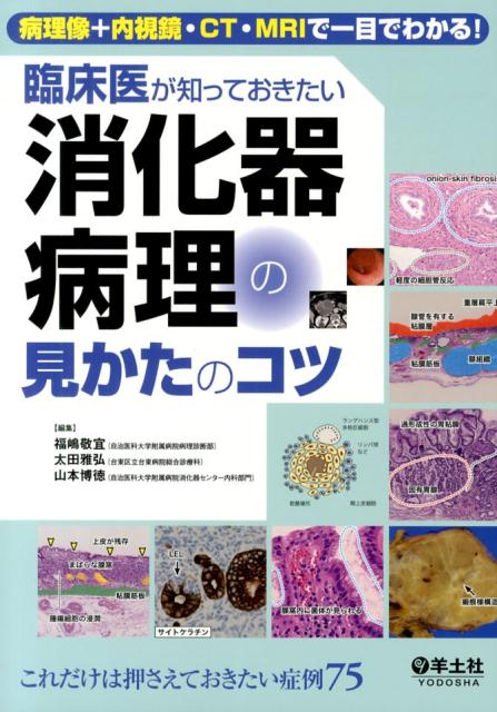 臨床医が知っておきたい消化器病理の見かたのコツ　病理像＋内視鏡・CT・MRIで一目でわかる！