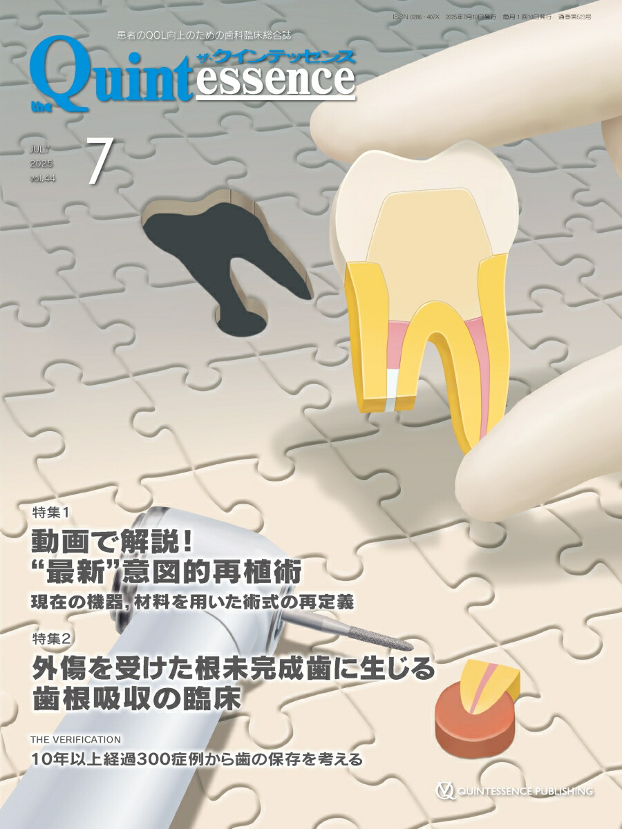 dショッピング |クインテッセンス出版 「QDT 2025年4月号 歯科