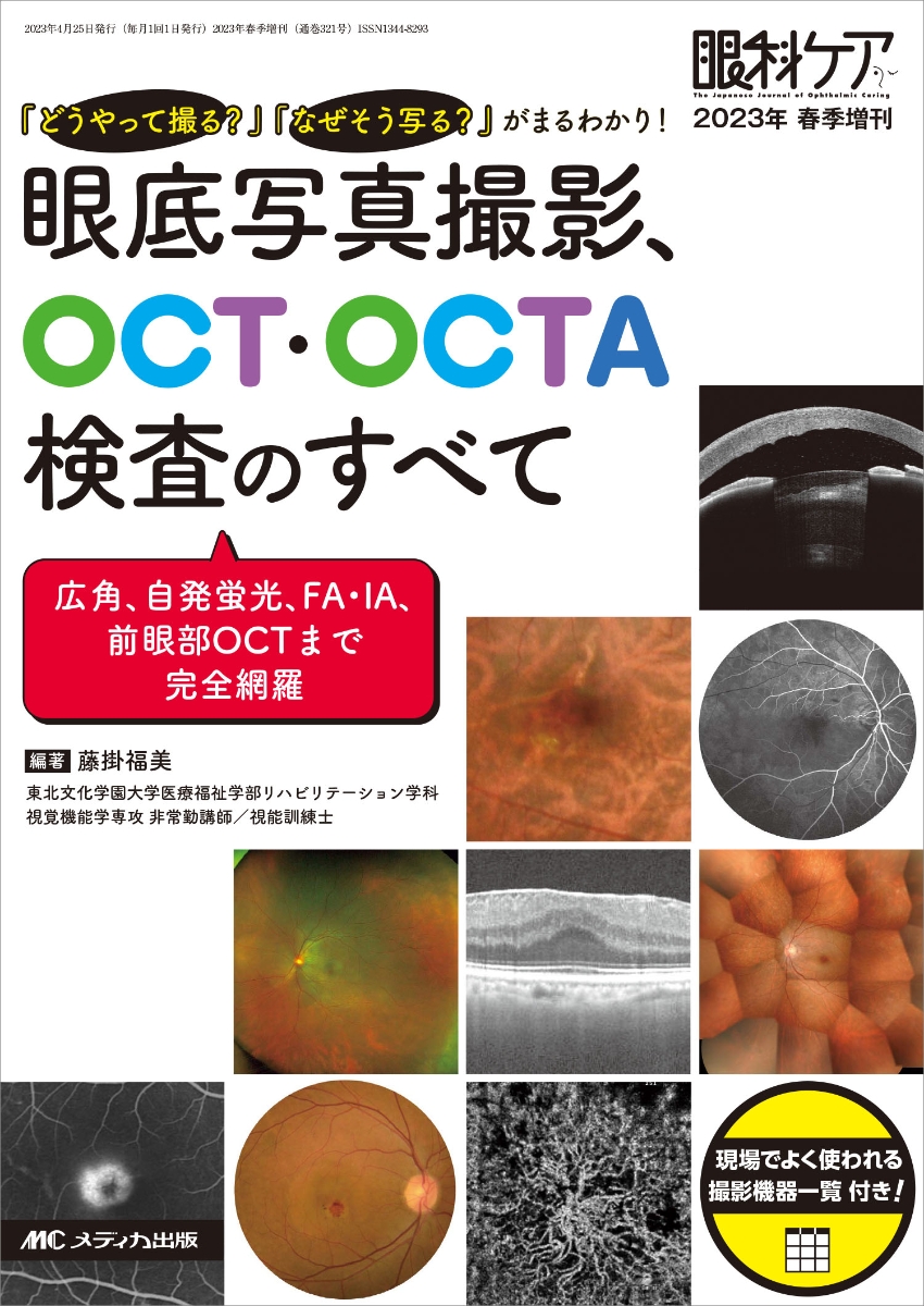 楽天ブックス: 眼底写真撮影、OCT・OCTA検査のすべて - 「どうやって