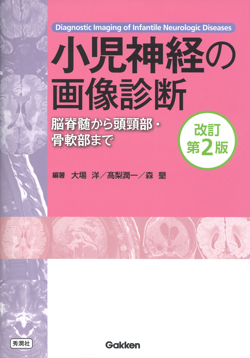 楽天ブックス: 小児神経の画像診断 改訂第2版 - ー脳脊髄から