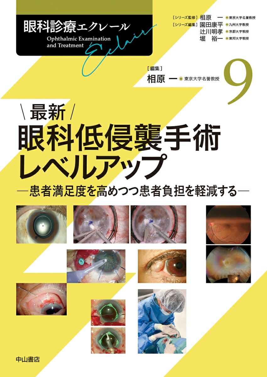 眼科診療エクレール最新 眼科低侵襲手術レベルアップ 9 楽天ブックス: 最新 眼科低侵襲手術レベルアップ（第9巻