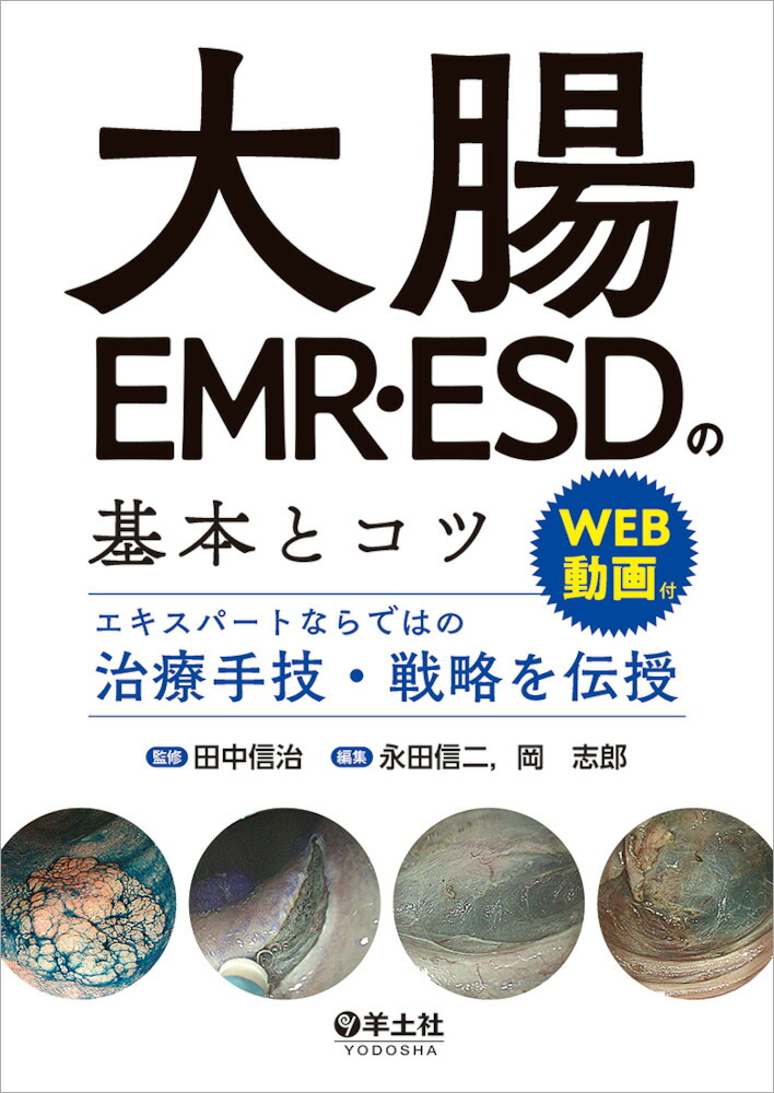 大腸EMR・ESDの基本とコツ 大腸EMR・ESDの基本とコツ〜エキスパート