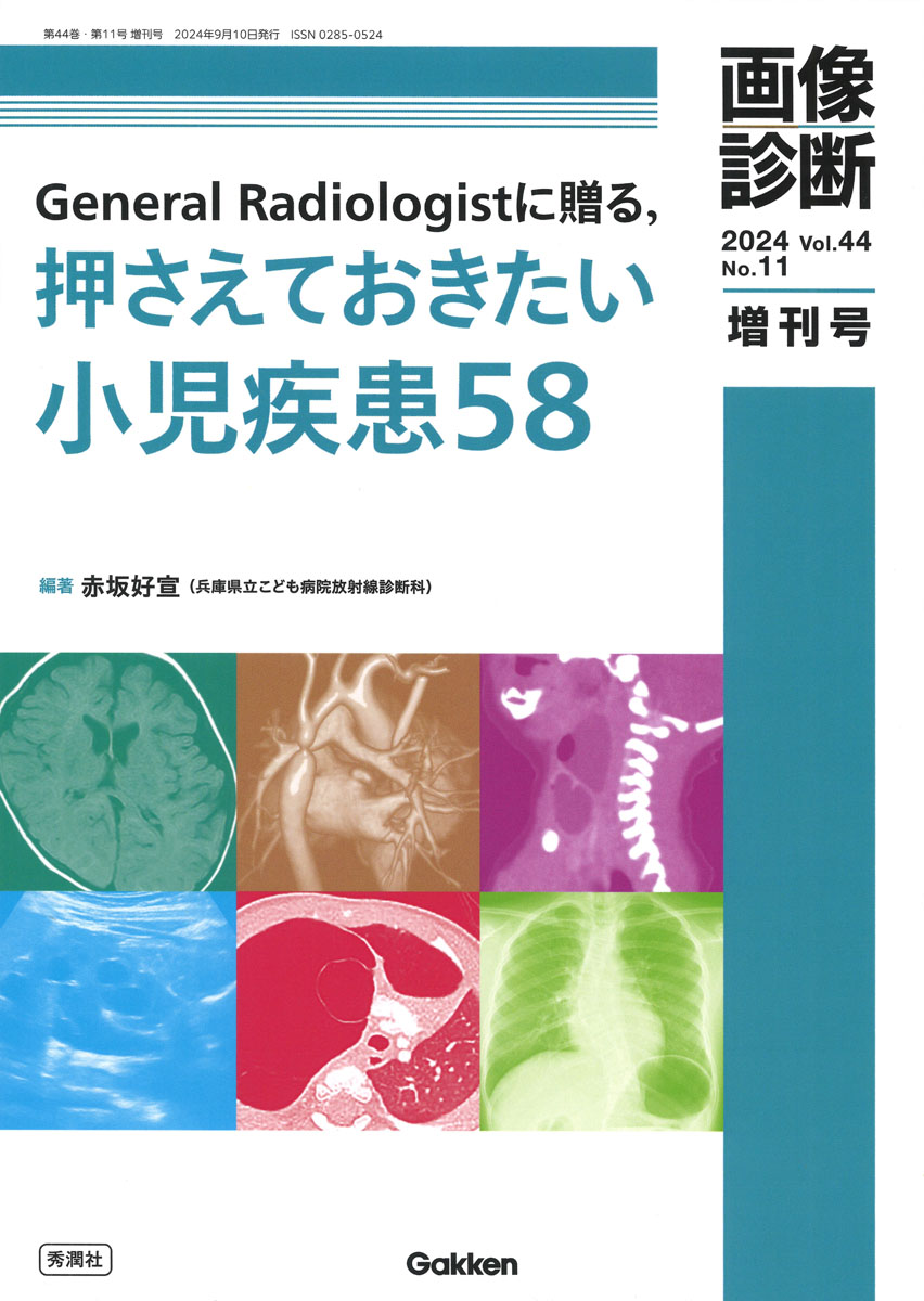 楽天ブックス: 画像診断2024年増刊号Vol．44 No．11 - General Radiologistに贈る，押さえておきたい小児疾患58 -  赤坂好宣 - 9784055200714 : 本