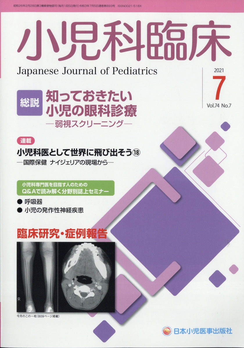 脳波所見をどう読むか 東間 正人 著 紀伊國屋書店ウェブストア オンライン書店 本 雑誌の通販 電子書籍ストア