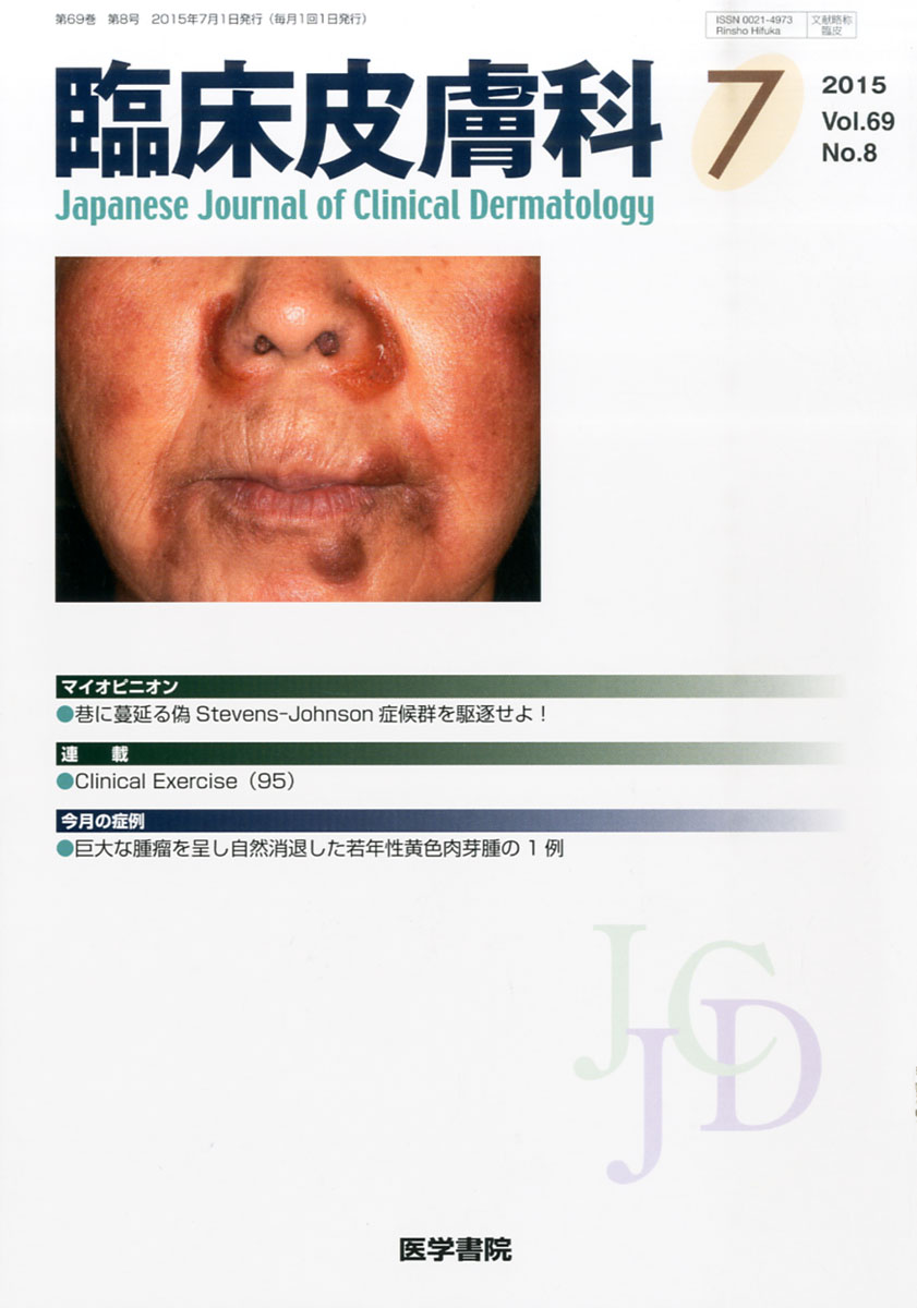 楽天ブックス: 臨床皮膚科 2015年 7月号 [雑誌] - 医学書院 