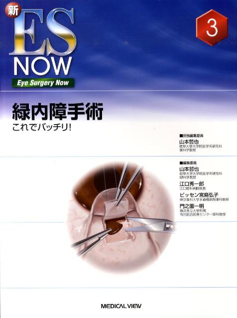 新ES now no.1 超音波白内障手術 新ES now no.1 超音波白内障手術