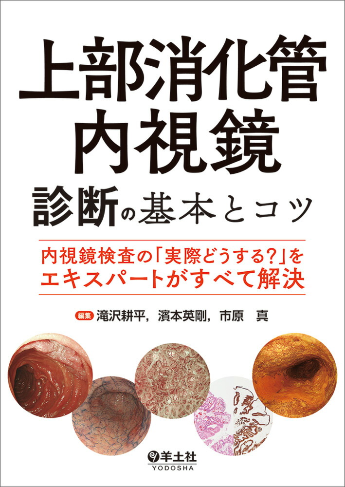 贈り物 Dr.平澤の上部消化管内視鏡診断セミナー 下巻